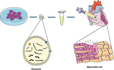 Cell Death and Exosomes Regulation After Myocardial Infarction and Ischemia-Reperfusion